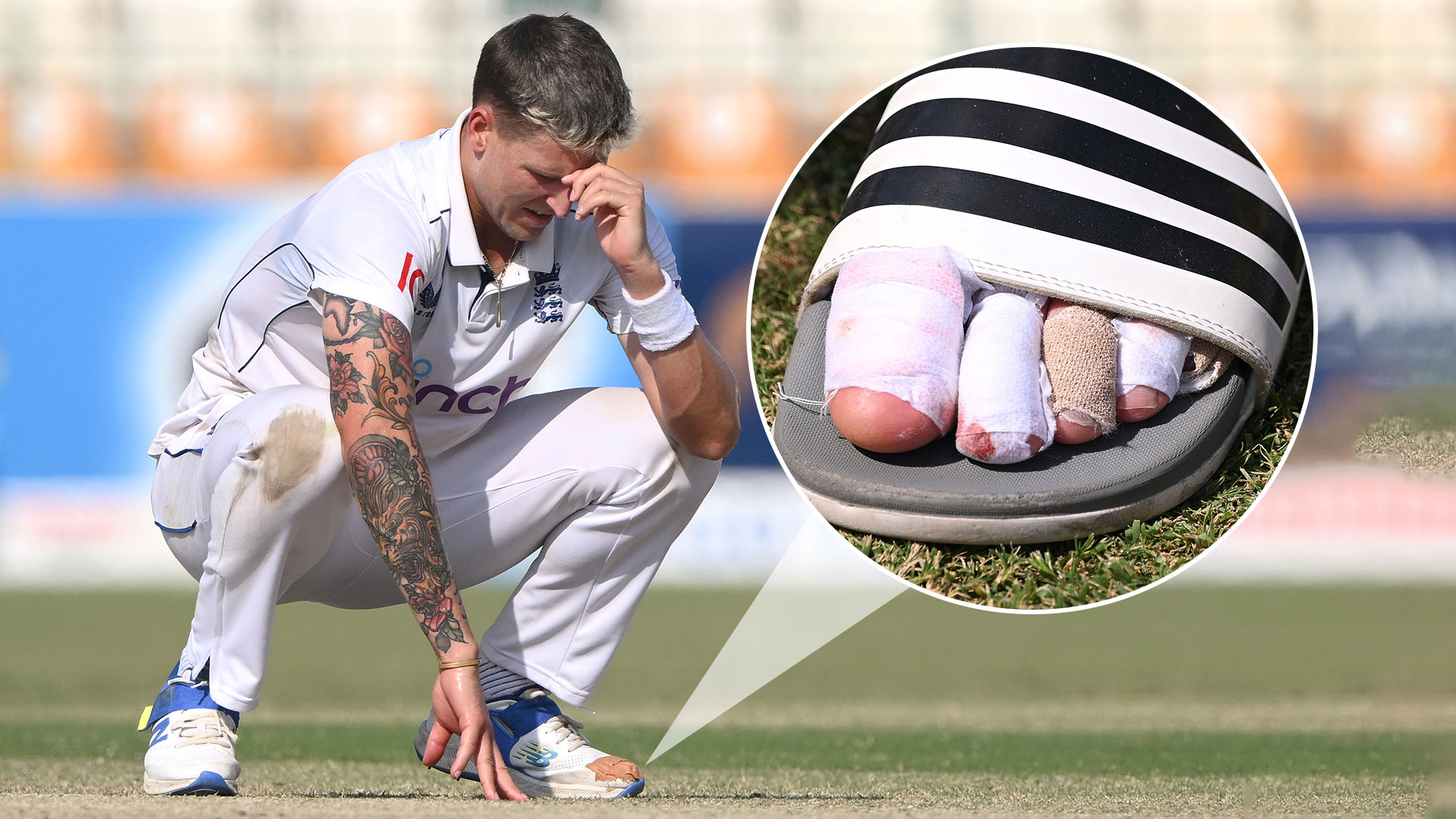 ‘I think I could get rid of my second toe’ – Brydon Carse reveals he considered toe amputation to tackle injury woes